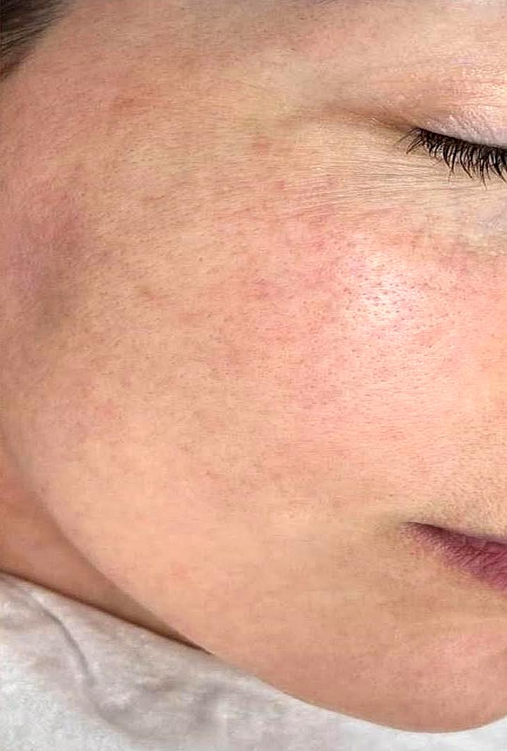 Après masque anti-âge ExoBlanc — grain de peau affiné éclat glass skin