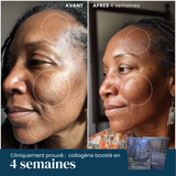 Masque Anti-Âge Régénérant et Repulpant — Exosomes & PDRN