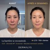 Crème ExoBlanc — résultats avant après peau repulpée 4 semaines