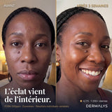 ExoBlanc™ — Masque Collagène Coréen PDRN & Exosomes