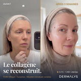 ExoBlanc™ — Masque Collagène Coréen PDRN & Exosomes
