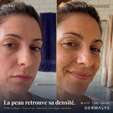ExoBlanc™ — Masque Collagène Coréen PDRN & Exosomes
