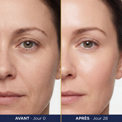DERMALYS ExoBlanc sur Instagram