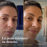 ExoBlanc™ — Korean Collagen PDRN & Exosomes Mask