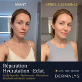 Sérum ExoBlanc — résultats avant après 4 semaines densité cutanée